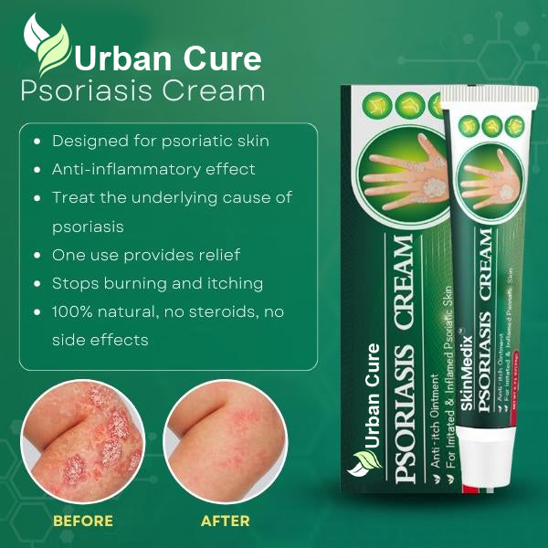Psoriasis Cream (Original) – 20g